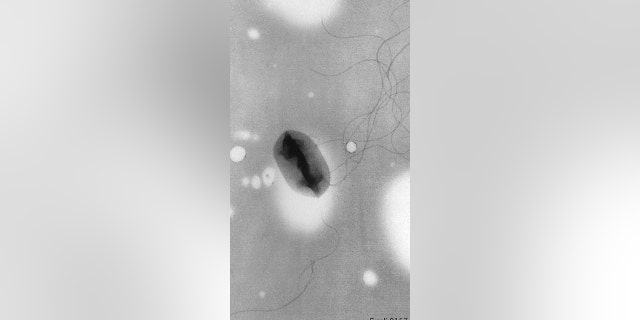 The ultrastructural morphology of a flagellated Escherichia coli O157:H7 bacterium