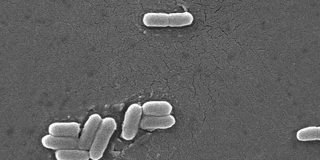 Escherichia coli bacteria of the strain O157:H7 under a microscope