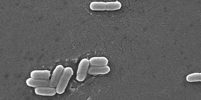 Escherichia coli bacteria of the strain O157:H7 under a microscope