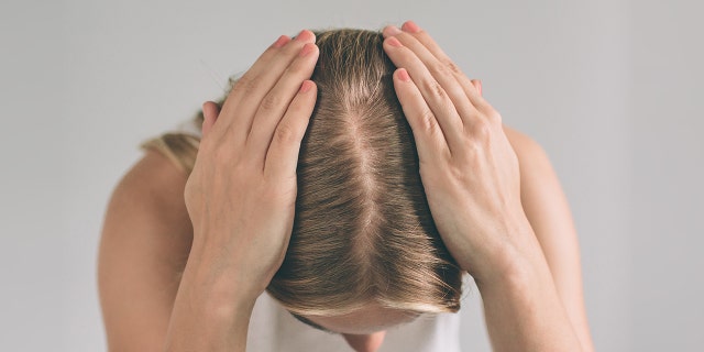 Scalp and hair study