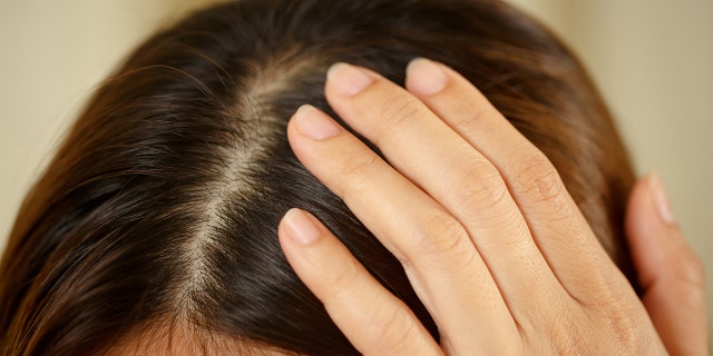 Scalp and hair study