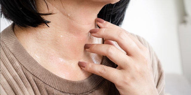 Close up of woman's sweaty neck.