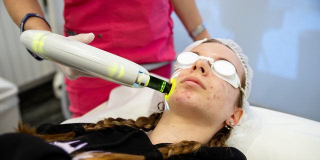 Woman gets laser treatment for acne.