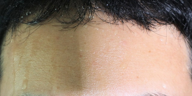 Close up of man's sweaty forehead.