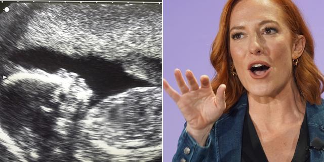 sonogram and Jen Psaki