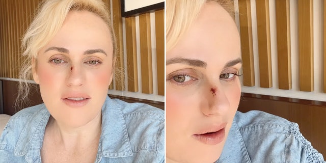 rebel wilson stitches split photo