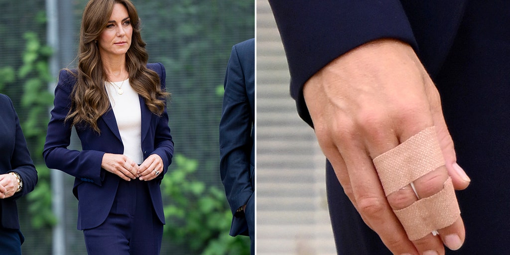 Kate Middleton injured after jumping on trampoline with her kids - Vimarsana News