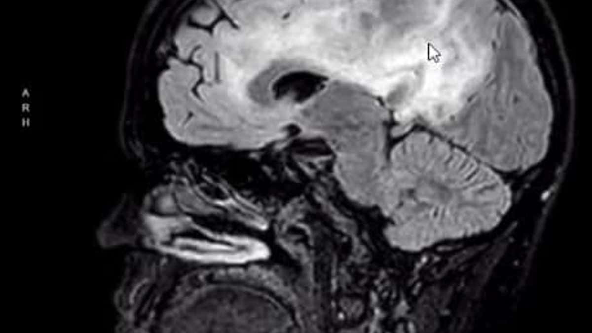 Tasha Kann brain scan