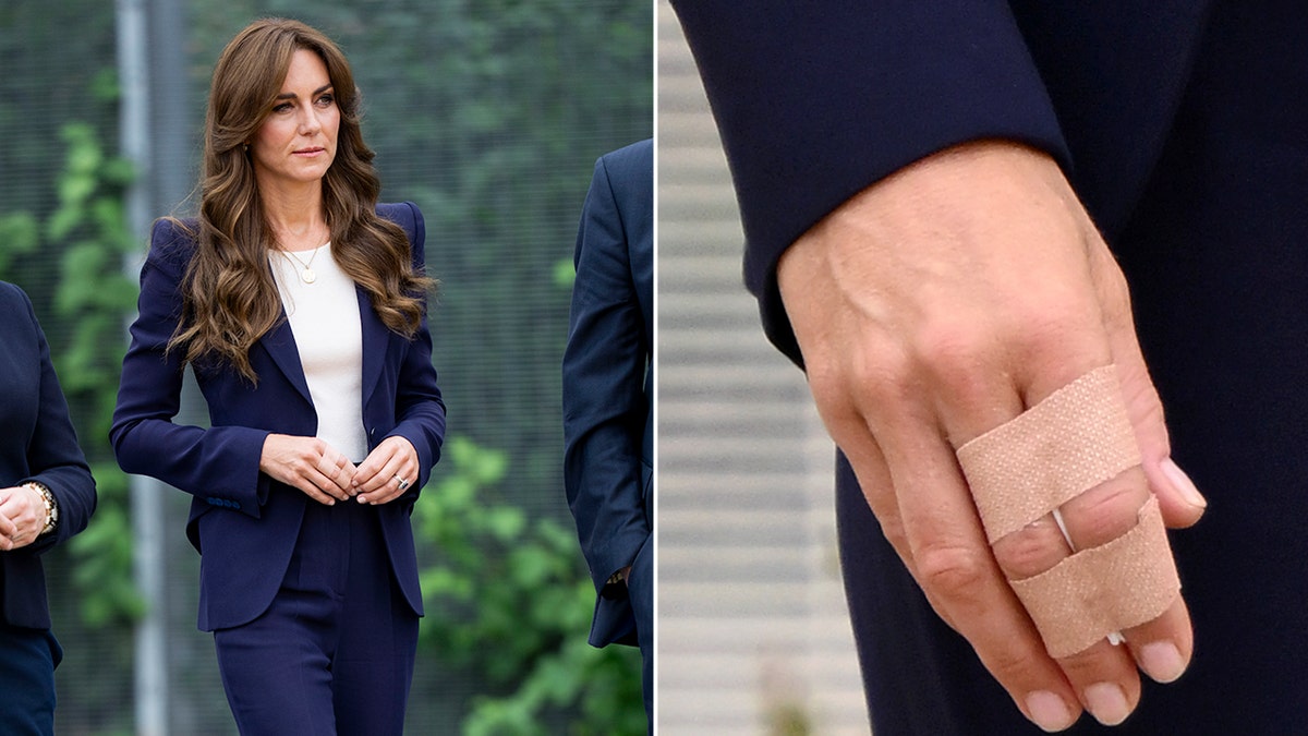 Split screen of Kate Middleton walking and close up on injured hand