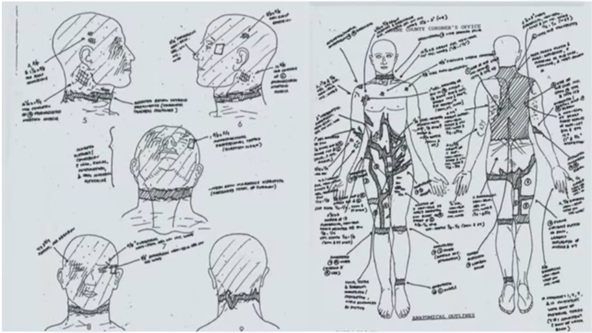 Shad Thyrion Autopsy diagram