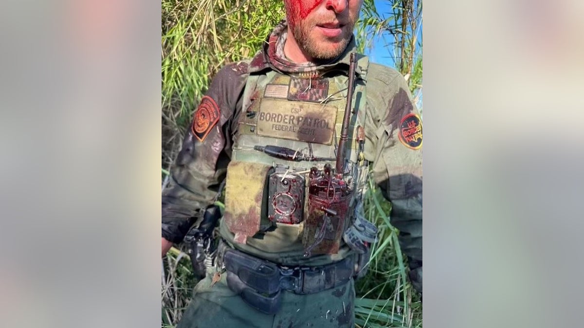 Um agente da Patrulha da Fronteira está com o rosto ensanguentado e sangue no colete protetor e no rádio em um mato no Texas.