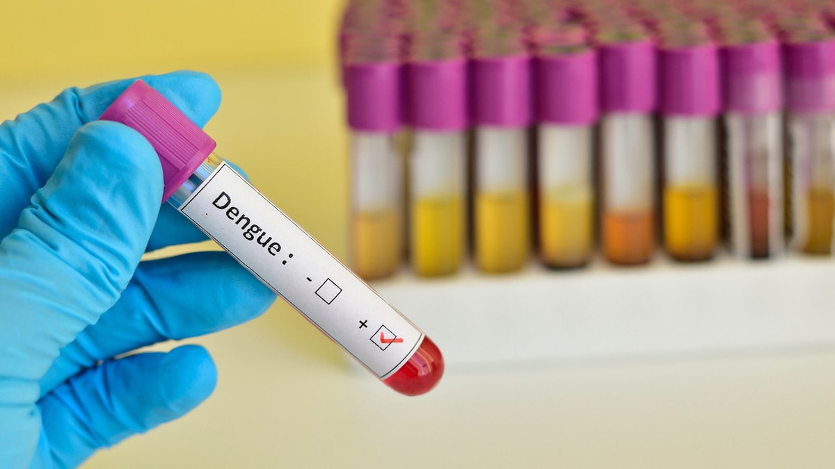 Dengue blood test