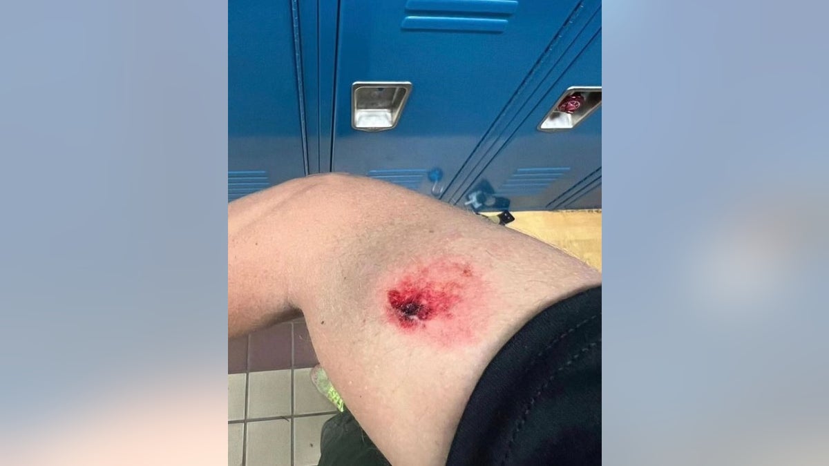 A Border Patrol agents shows a bloody injury to his leg inside a locker room