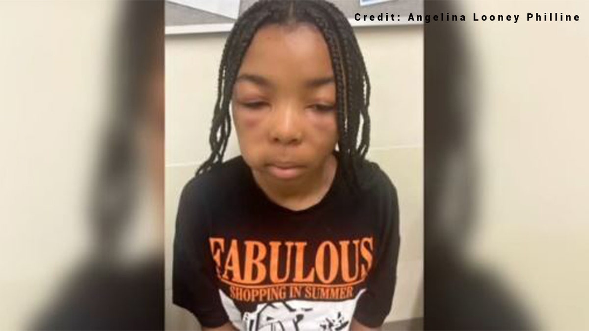 13-year-old girl attacked at Southern California McDonald’s as bystanders take out phones and record