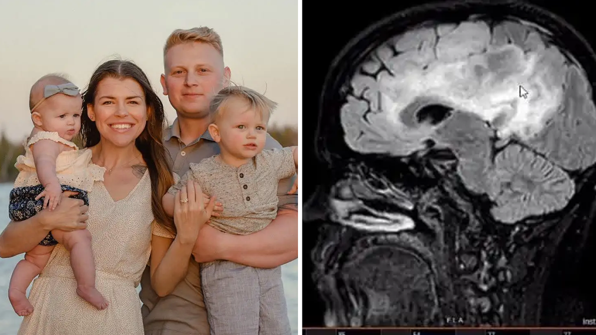 Brain cancer abortion