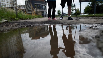 Ukraine faces future with upwards of 20K amputees as war with Russia rages on