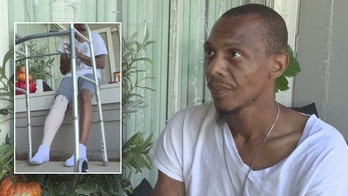 Georgia man pistol whipped, shot while taking out trash at apartment complex: 'Just thank God for being alive'