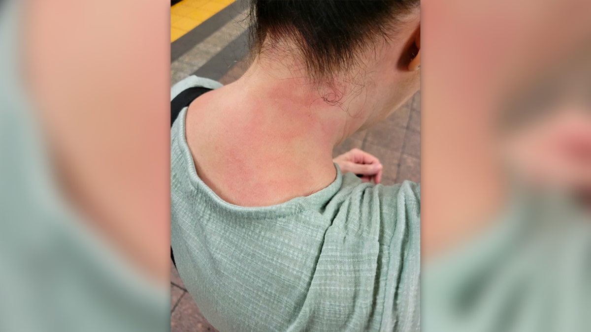 Grand Central selfie showing marks on back of victim's neck