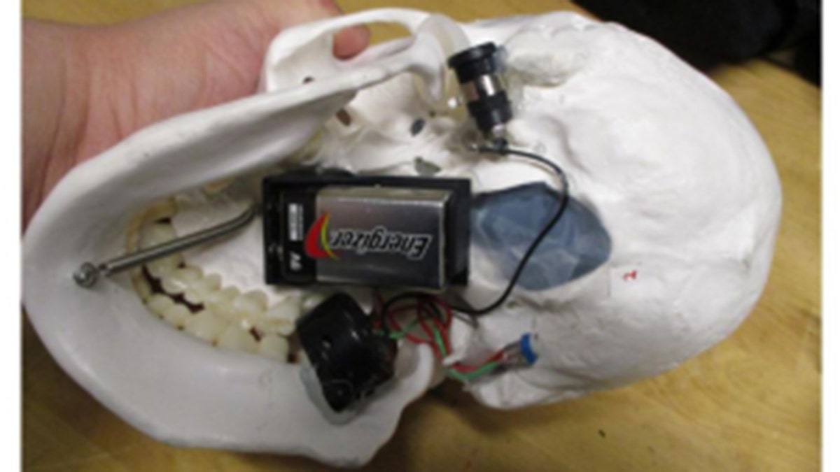 Look at skull "medical device" with battery inside