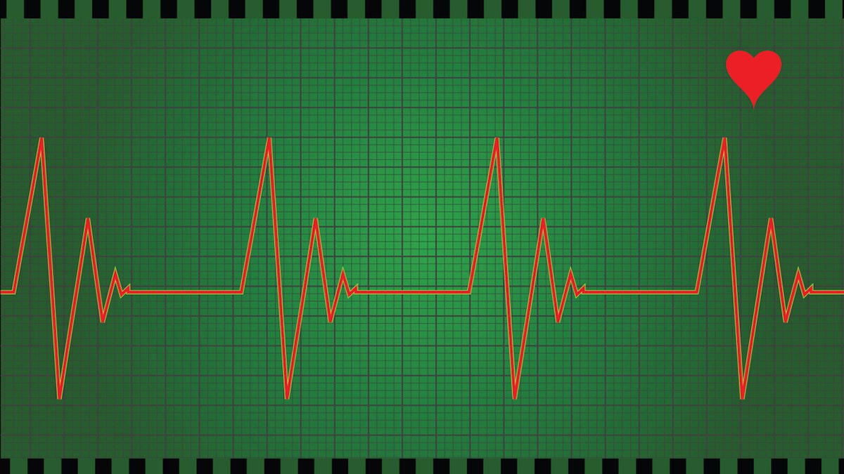 Heart monitor