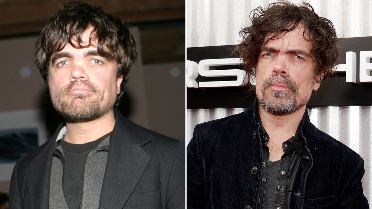 Peter Dinklage then and now split