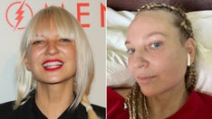 'Chandelier’ singer Sia’s plastic surgeon reveals why she was honest about facelift at 47, 'No shame in it'