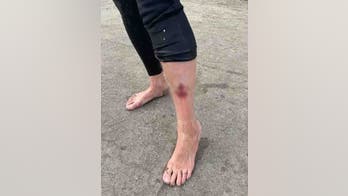 California surfer suffers bite to leg in reported shark attack