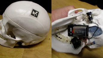 Bag containing 'suspicious' skull shuts down airport baggage screening for nearly 2 hours