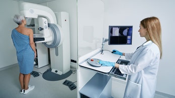 Breast cancer breakthrough: AI predicts a third of cases prior to diagnosis in mammography study
