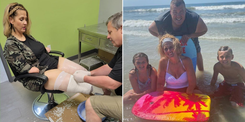Ohio woman who lost all four limbs to flu complications speaks out to raise awareness - Vimarsana News
