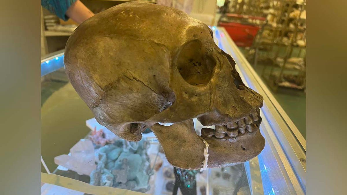 Police believe this is a human skull