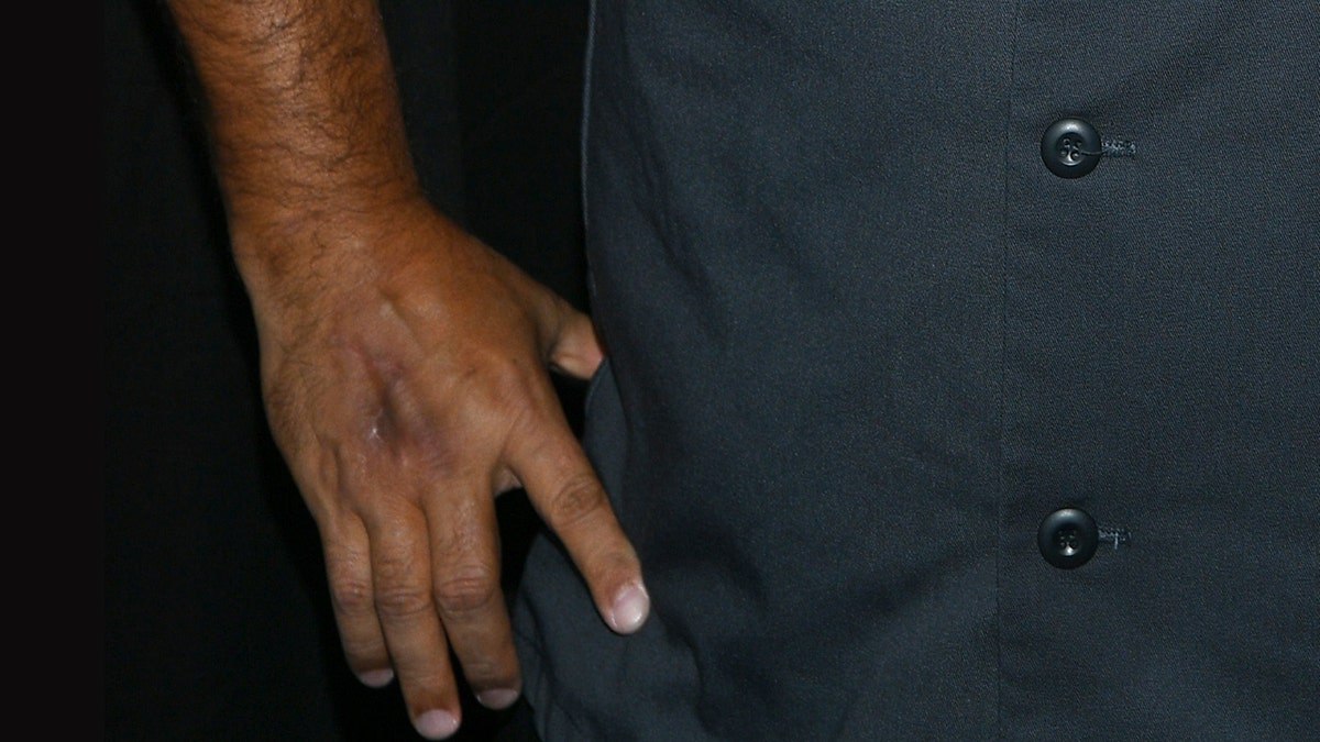 A close-up of Buddy Valastros injured hand