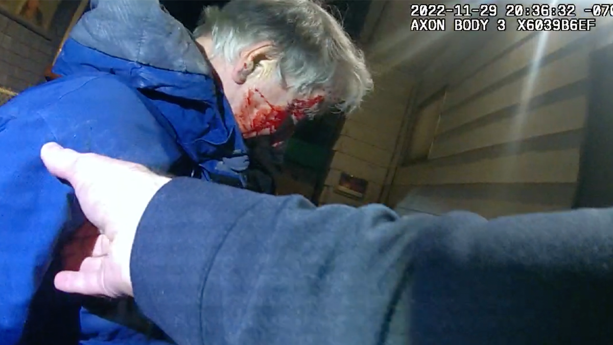 Bloodied man's face after arrest