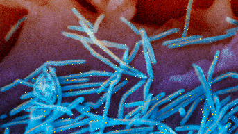 DC area hospitals report uptick in sick visits as global concern for respiratory illnesses grows