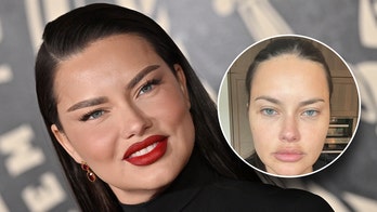 Former Victoria's Secret model Adriana Lima responds to plastic surgery accusations
