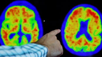 Several Alzheimer's vaccines enter clinical trials amid breakthrough treatments' success