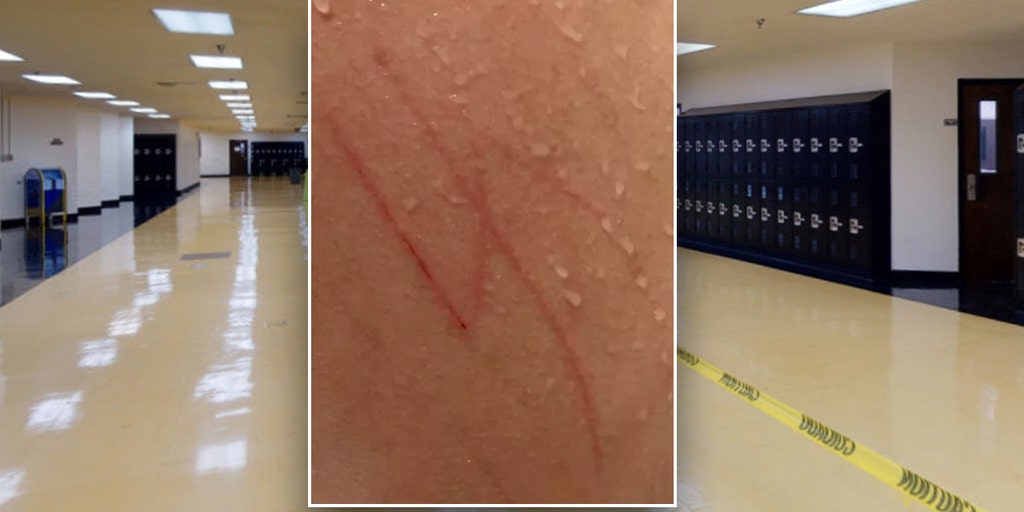Las Vegas special needs student returns home with swastika etched on back, parents file legal complaint - Vimarsana News