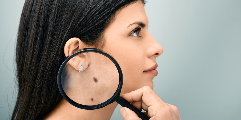 Vaccine for deadly skin cancer shows 'groundbreaking' results in clinical trial - Vimarsana News
