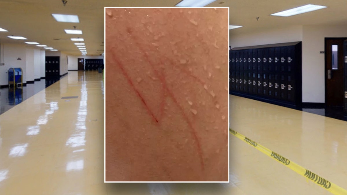 Las Vegas special needs student returns home with swastika etched on back, parents file legal complaint 2 Swastika