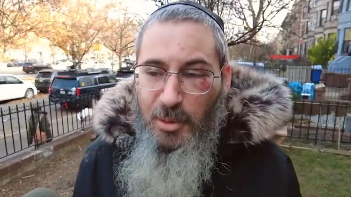 NYC Jewish Man Punched, Robbed Outside His Home On First Day Of ...