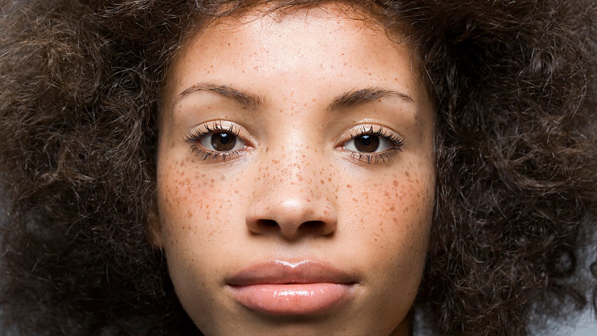 freckles on woman's face
