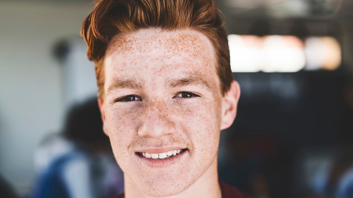freckles on man's face