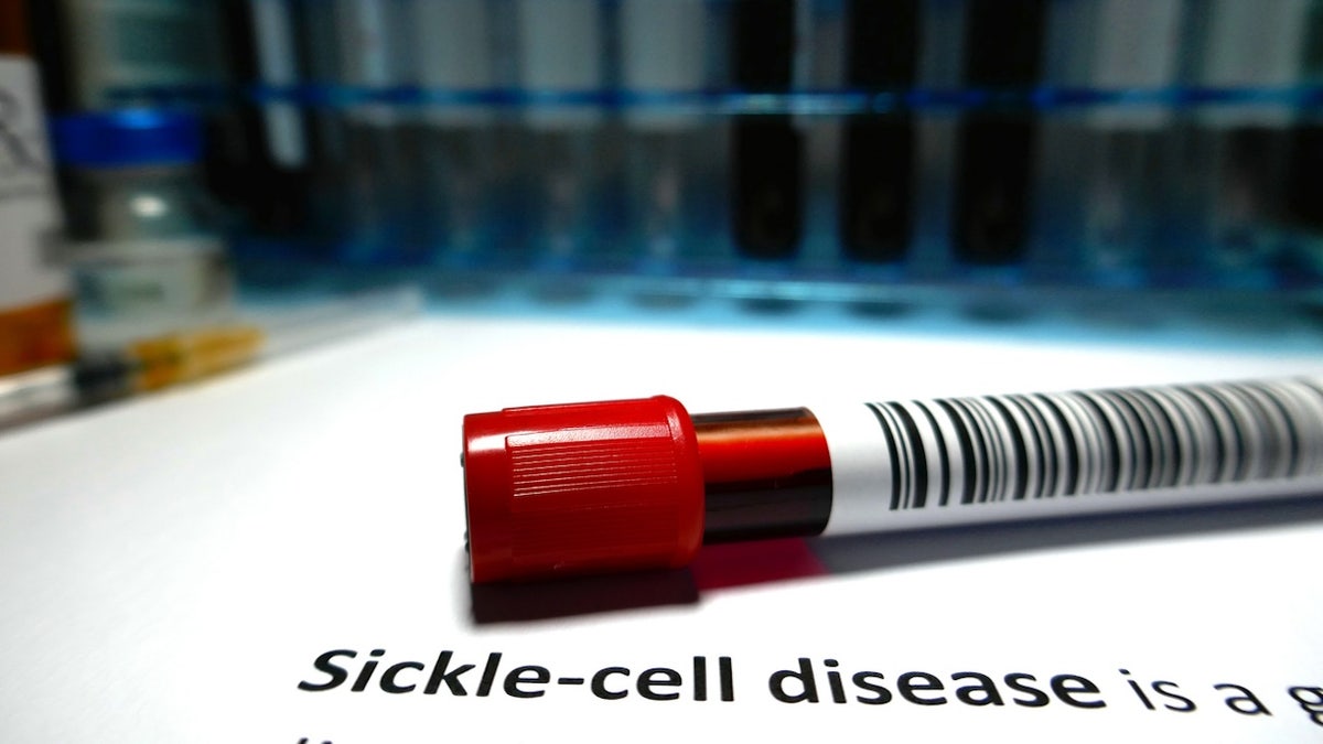 FDA Approves Sickle Cell Disease Treatment That Uses ‘remarkable’ Gene ...