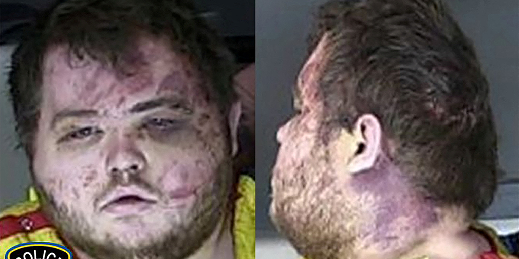 Colorado LGBTQ+ nightclub shooter to plead guilty to federal hate crimes - Vimarsana News