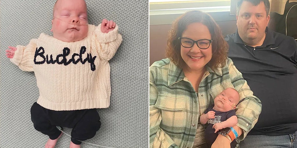 Nebraska baby heads home after being smallest infant to survive at hospital: 'Joyful day' - Vimarsana News