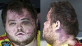 Anderson Lee Aldrich, 22, the suspect in the mass shooting that killed five people at an LGBTQ nightclub appears showing facial injuries in police booking photographs released in Colorado Springs.