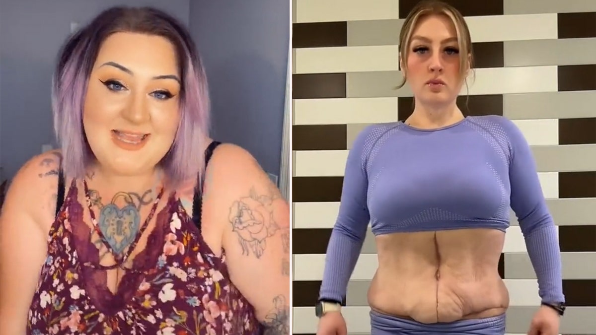 TikTok botched plastic surgery