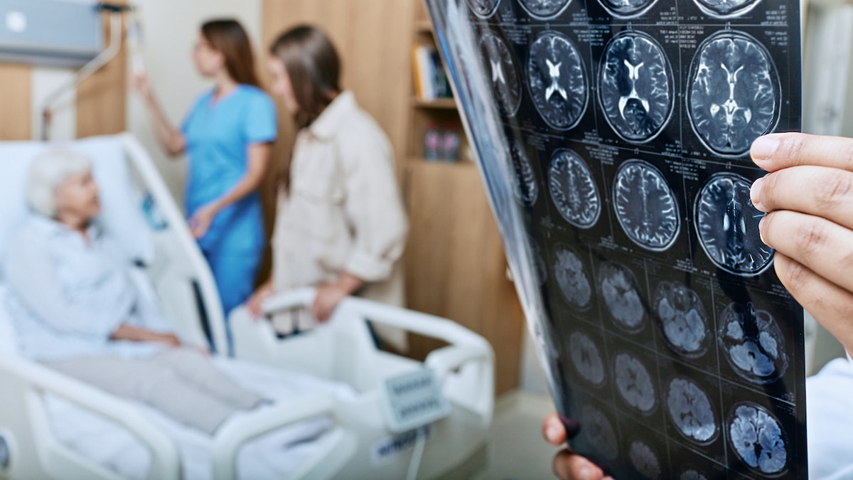 Alzheimer's patient - brain scans