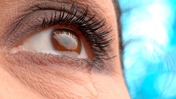 All eyes are on glaucoma, the ‘silent thief of sight’ — and the truth behind 7 myths