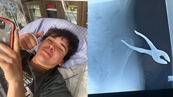 Kansas teen impaled by pliers after freak accident: 'I didn't know they were in there'